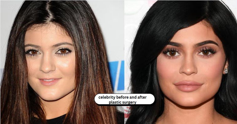 Celebrity Before and After Plastic Surgery: What Really Changes? celebrity before and after plastic surgery